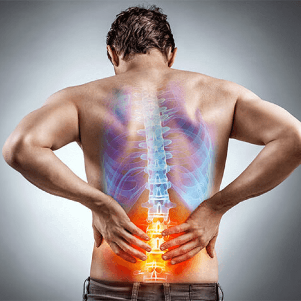 Lumbar Spine Stenosis