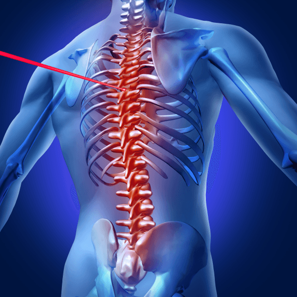 Laser Spine Surgery