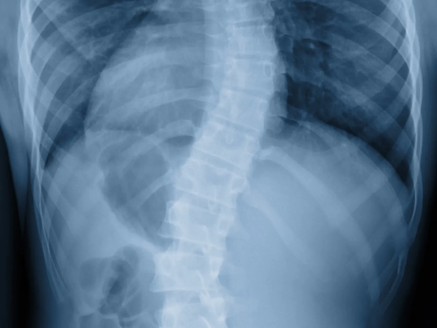 Deformity corrections
