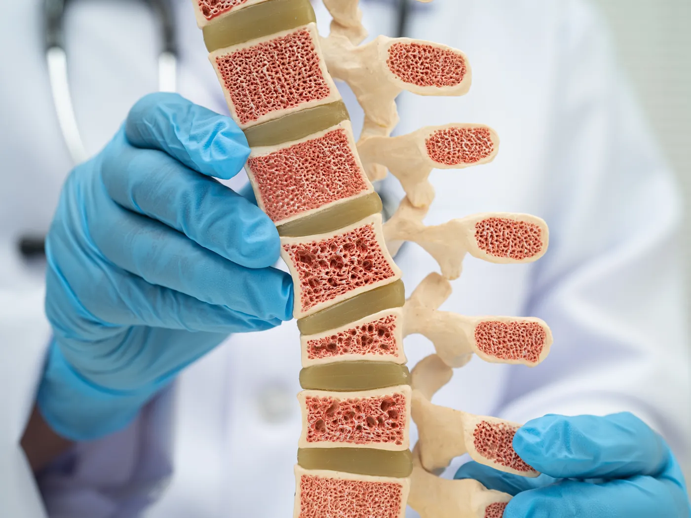 Osteoporotic spine fractures